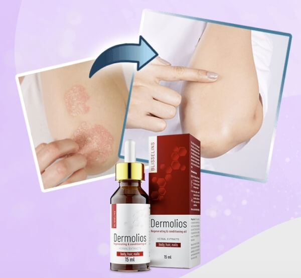 Dermolios Мнения на Клиенти по Форумите Dermolios Олио България - Мнения, цена, ефекти